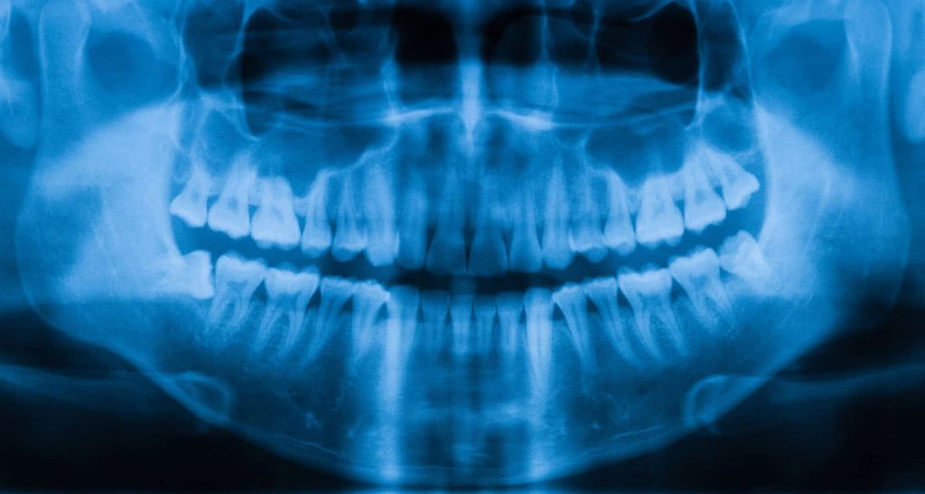IA brasileira identifica sexo a partir de raio-X dentário
