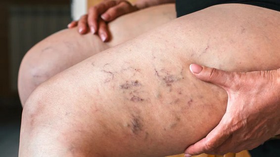 Má circulação sanguínea? Eis o treino ideal para o sistema linfático