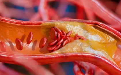 5 alimentos ricos em proteína que também têm muita gordura; veja quais